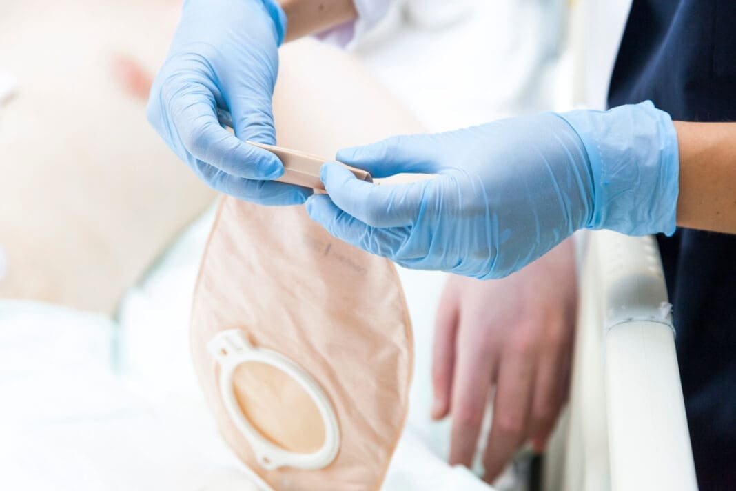 Neue Stomasprechstunde in den GFO Kliniken Südwestfalen